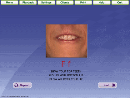 Software for apraxia of speech ('speech apraxia'), articulation - screenshot